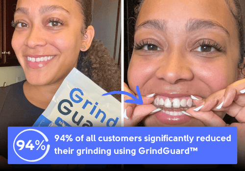 GrindGuard Plus | Grinding Mouth Guard